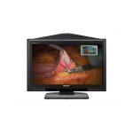 OPERATION MEDICALE PAR VISIOCONFERENCE SONY PCS XL55