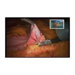 OPERATION MEDICALE PAR VISIOCONFERENCE SONY PCS XL55 – Image 3