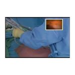 OPERATION MEDICALE PAR VISIOCONFERENCE SONY PCS XL55 – Image 4