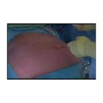 OPERATION MEDICALE PAR VISIOCONFERENCE SONY PCS XL55 – Image 2